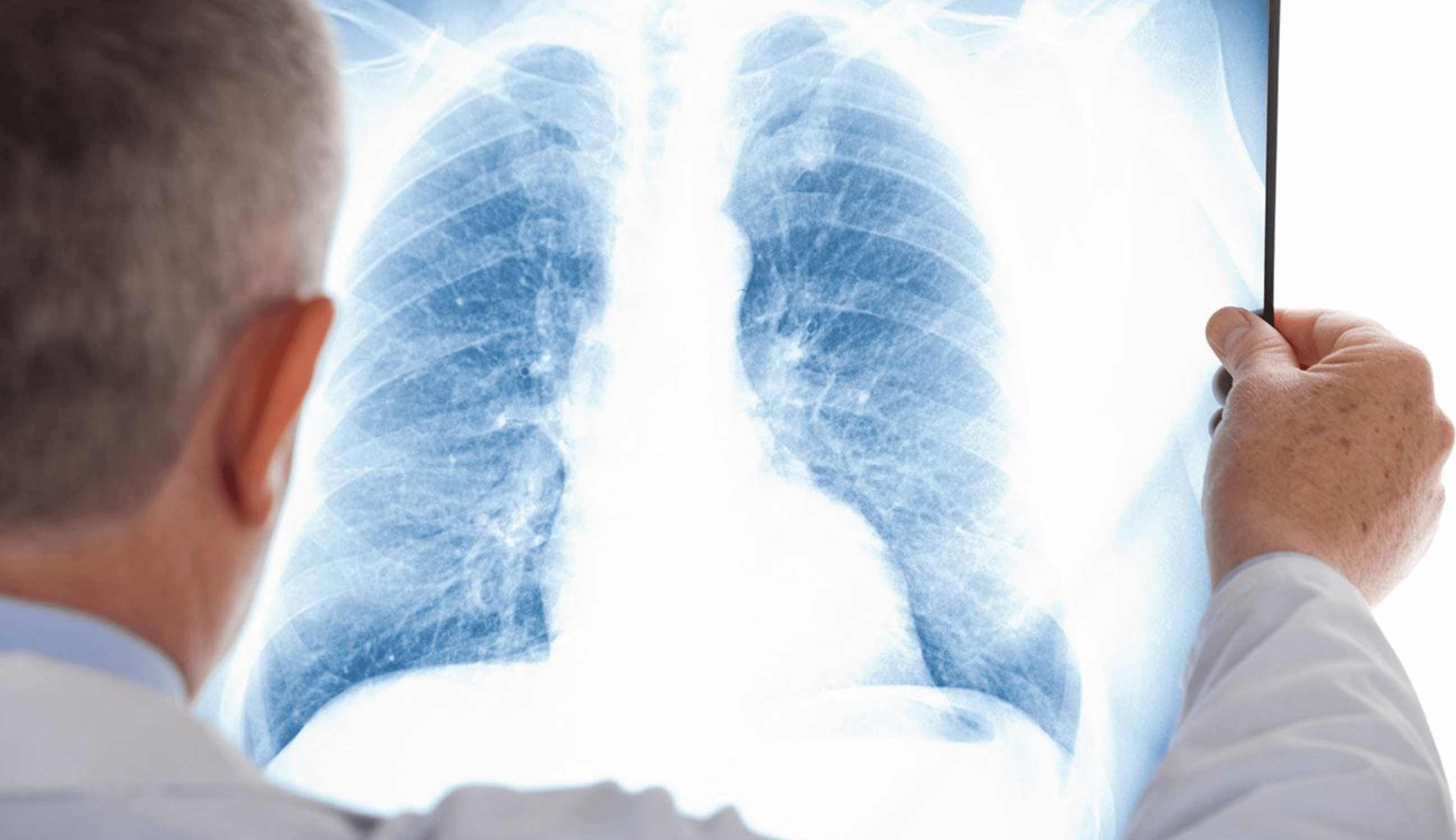 금연후 기간별 상태