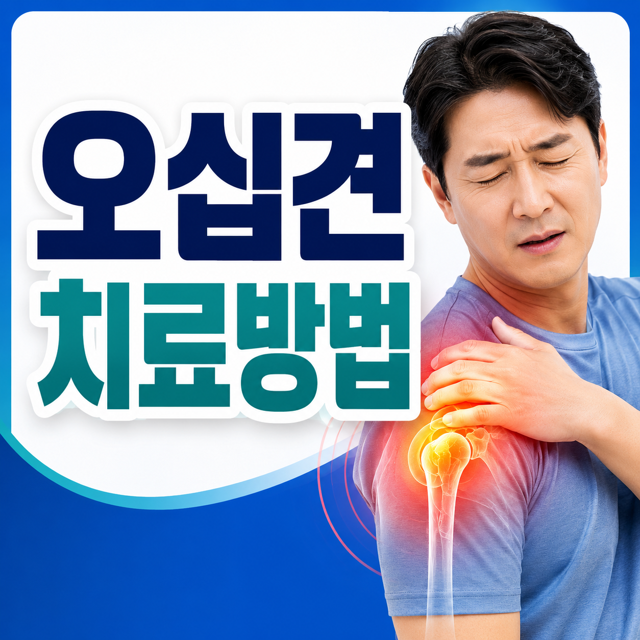 오십견 치료방법