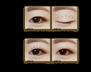 남자 눈매 교정술