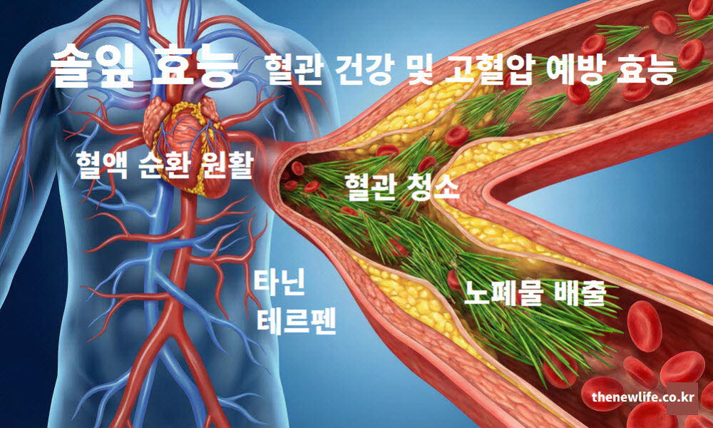 솔잎 효능 혈관 건강 고혈압 예방