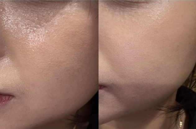 유분 즉시 삭제? 여름철 뽀송함 유지력! (번들거림, 끈적임 없이)