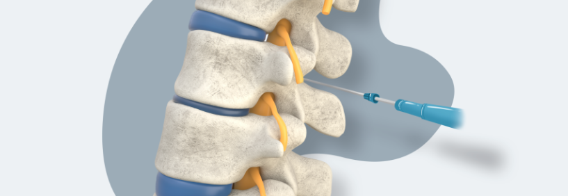 배부신경 차단술1