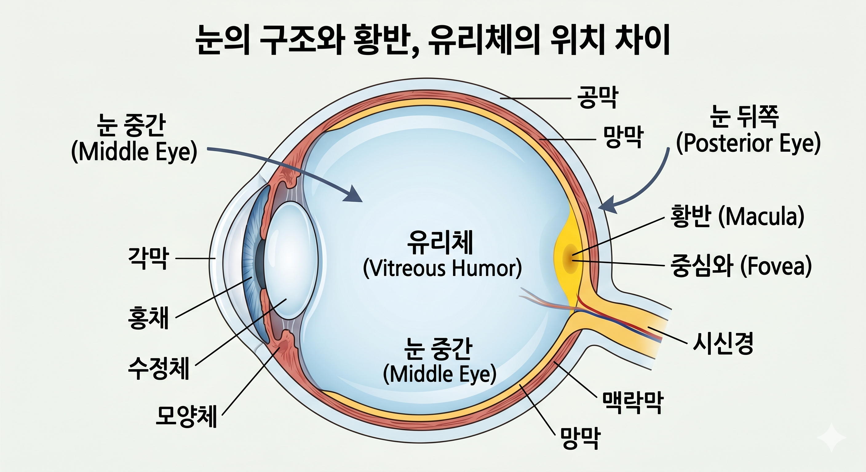 눈 구조 이미지로 눈 뒤쪽 황반과 눈 중간 유리체의 위치 차이를 쉽게 보여주는 일러스트