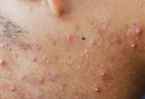 올영 100% 활용법