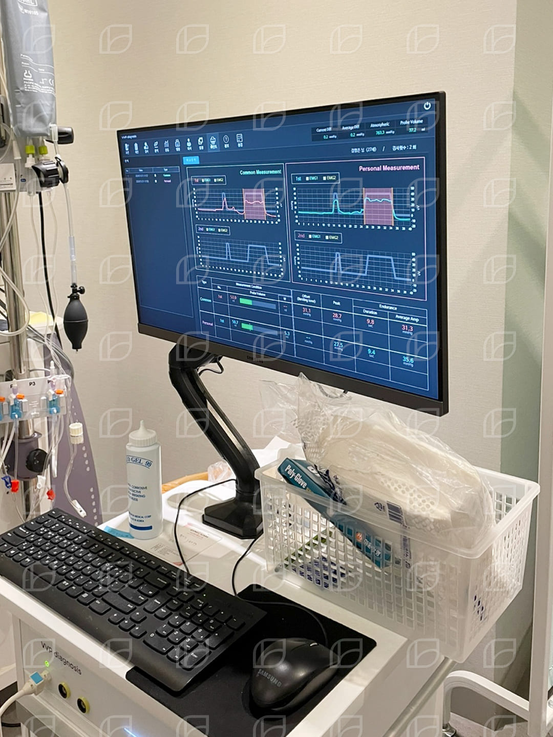 질수축 여성불감증 치료 질축소수술이란?