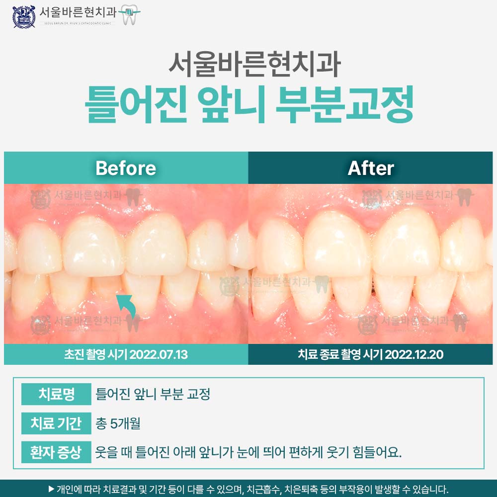 해운대교정치과