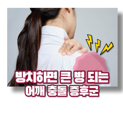 어깨 충돌 증후군 원인과 대처방법
