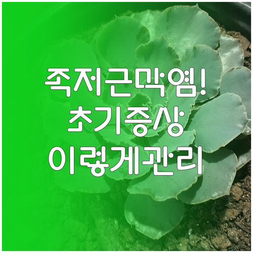족저근막염 초기 증상과 자가 관리법..
