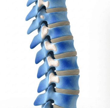 골다공증 약 종류와 효과 비교3