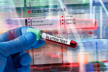 실리악병은 글루텐에 대한 알레르기 반응으로&#44; 밀&#44; 보리&#44; 호밀 같은 곡물에 포함된 단백질이 원인이죠. 오늘은 실리악병의 원인&#44; 증상&#44; 그리고 글루텐 프리 생활로 건강을 지킬 수 있는 방법까지&#44; 모든 것을 알기 쉽게 설명해 드릴게요. 우리 함께 실리악병과 글루텐 프리 다이어트에 대해 알아보아요!