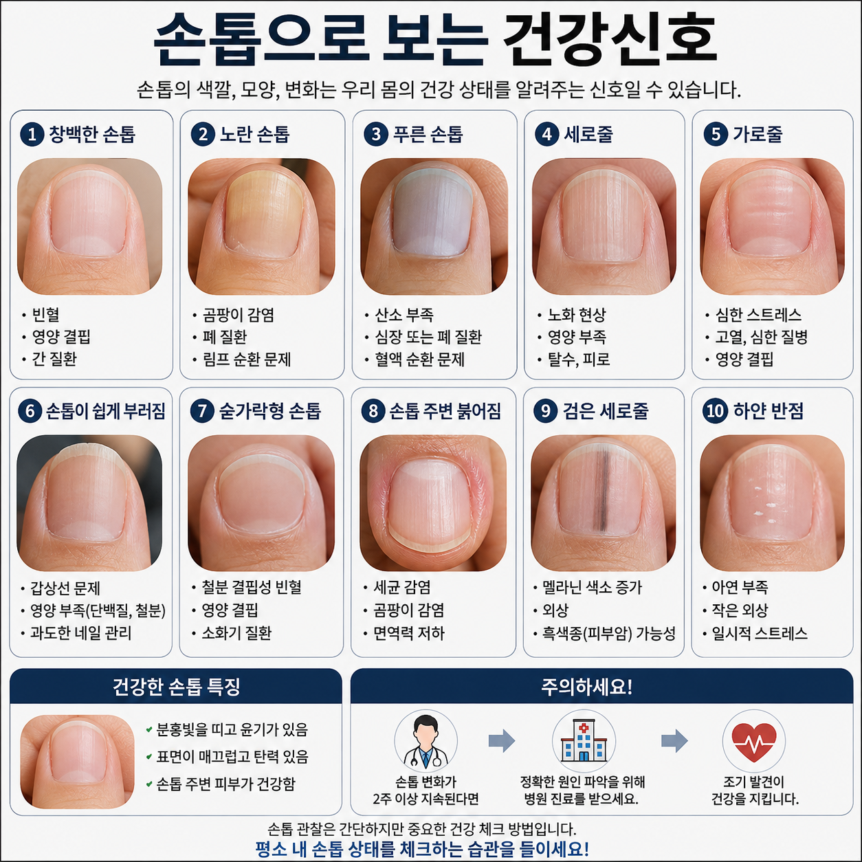 손톱 건강 신호