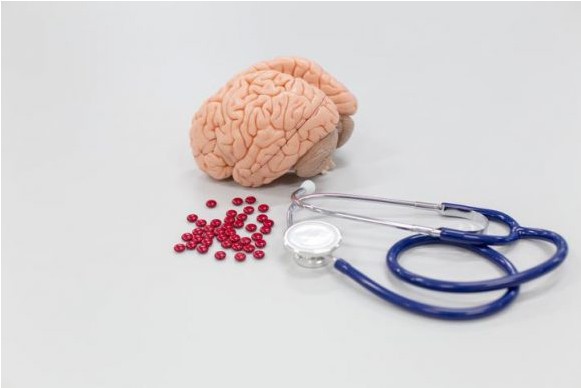 알츠하이머 콜린성분