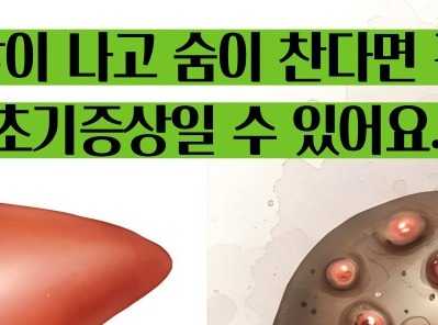 간경화 초기증상