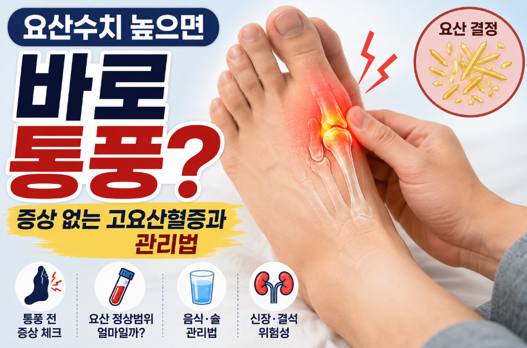 요산수치 높으면 바로 통풍? 증상 없는 고요산혈증과 관리법