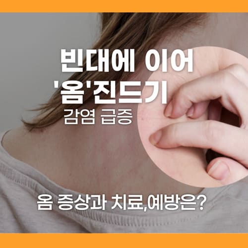 옴에 대하여