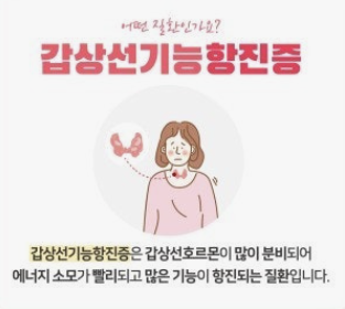 갑상선 기능 저하증 증상