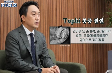 통풍결절