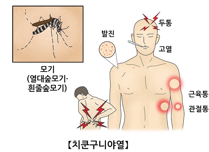 치쿤구니야열