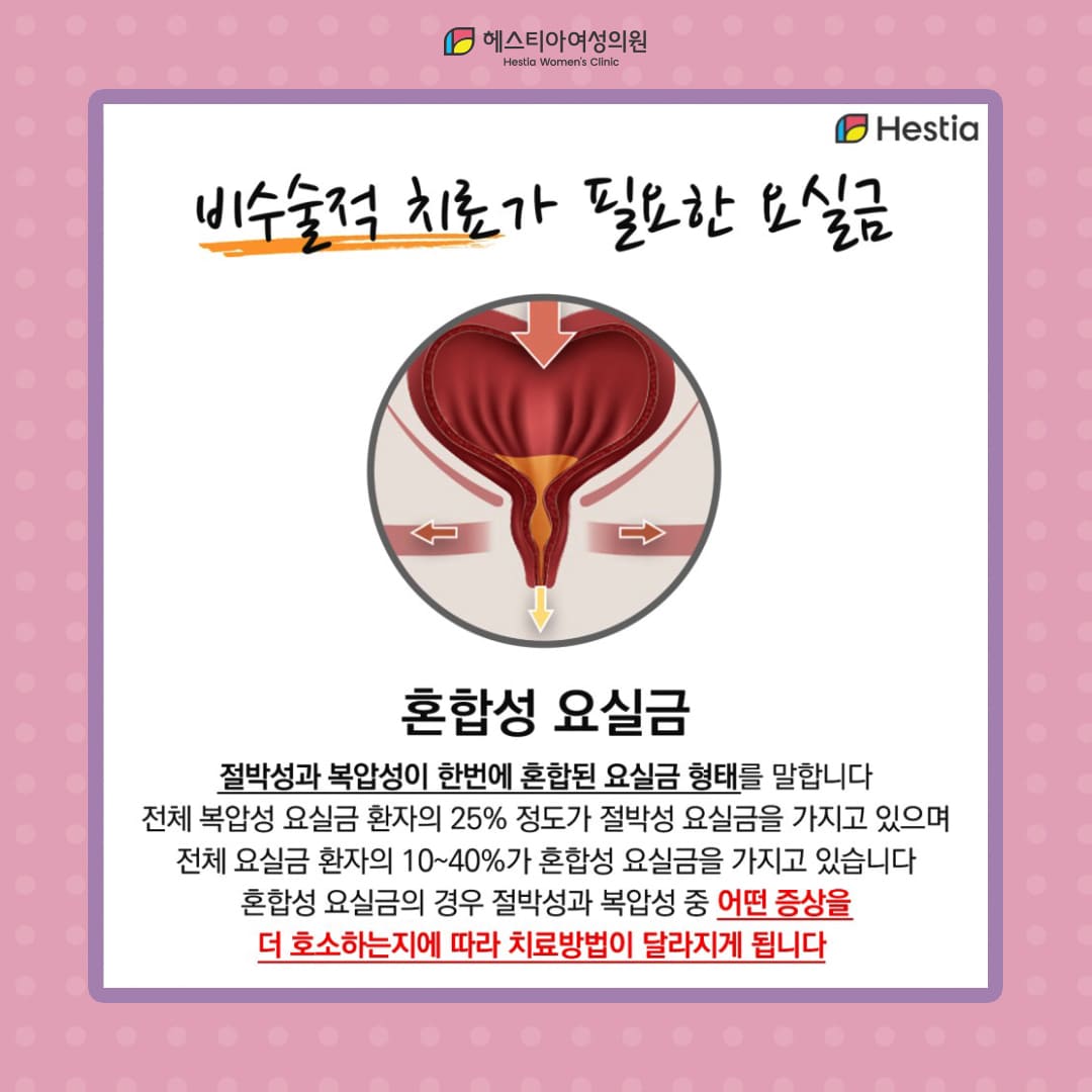 요실금 수술이 필요하지 않은 혼합성 요실금