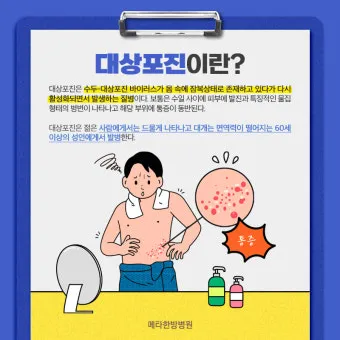 대상포진 치료방법에 대한 총정리 건강 질병관리_11
