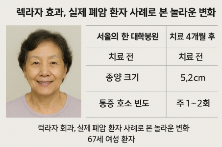 실제 폐암 환자