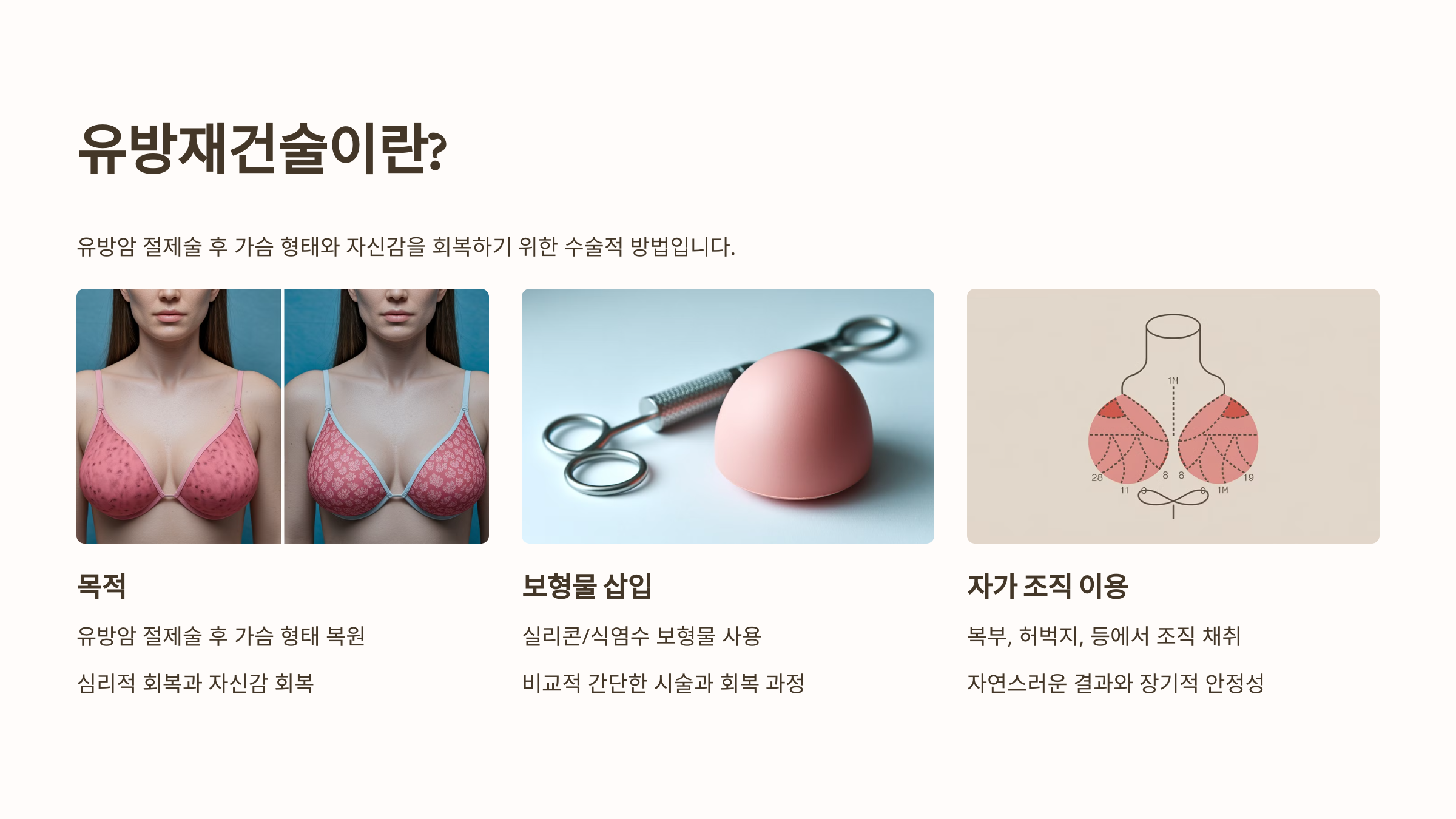 유방재건술이란?