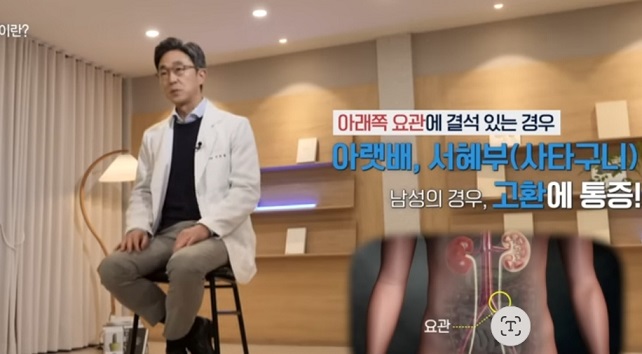 요로결석-구교철-교수