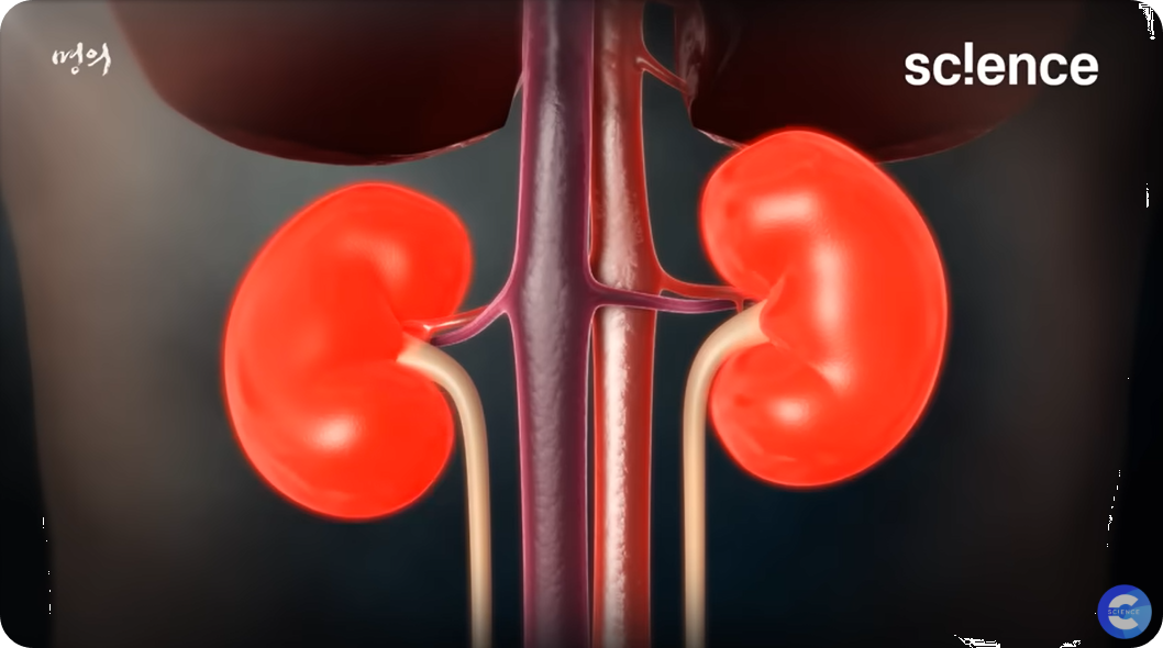 신장, 콩팥, 신장질환, 신장치료. 임상연구,