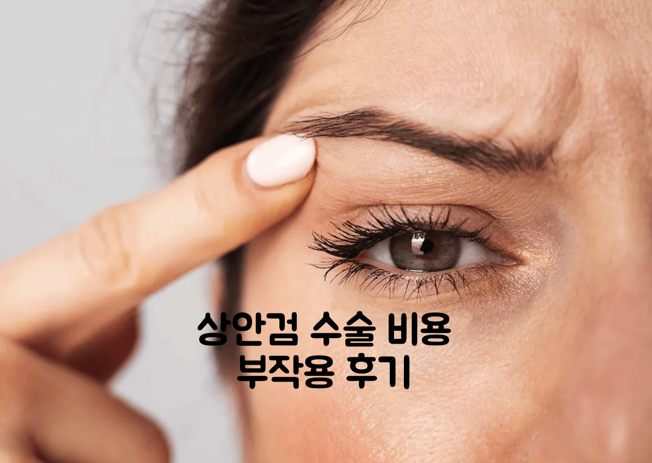 상안검 수술 비용