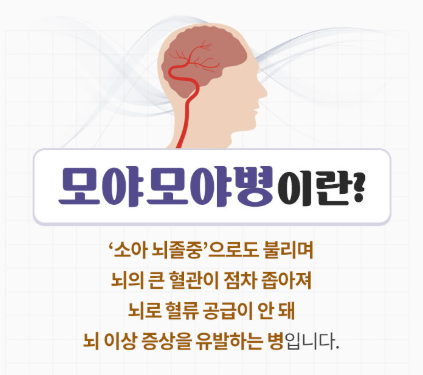 모야모야병 뜻
출처 : 가톨릭대학교 여의도성모병원