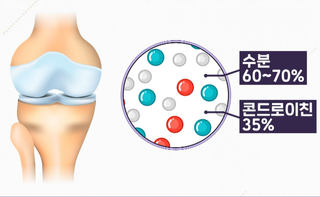 콘드로이친
