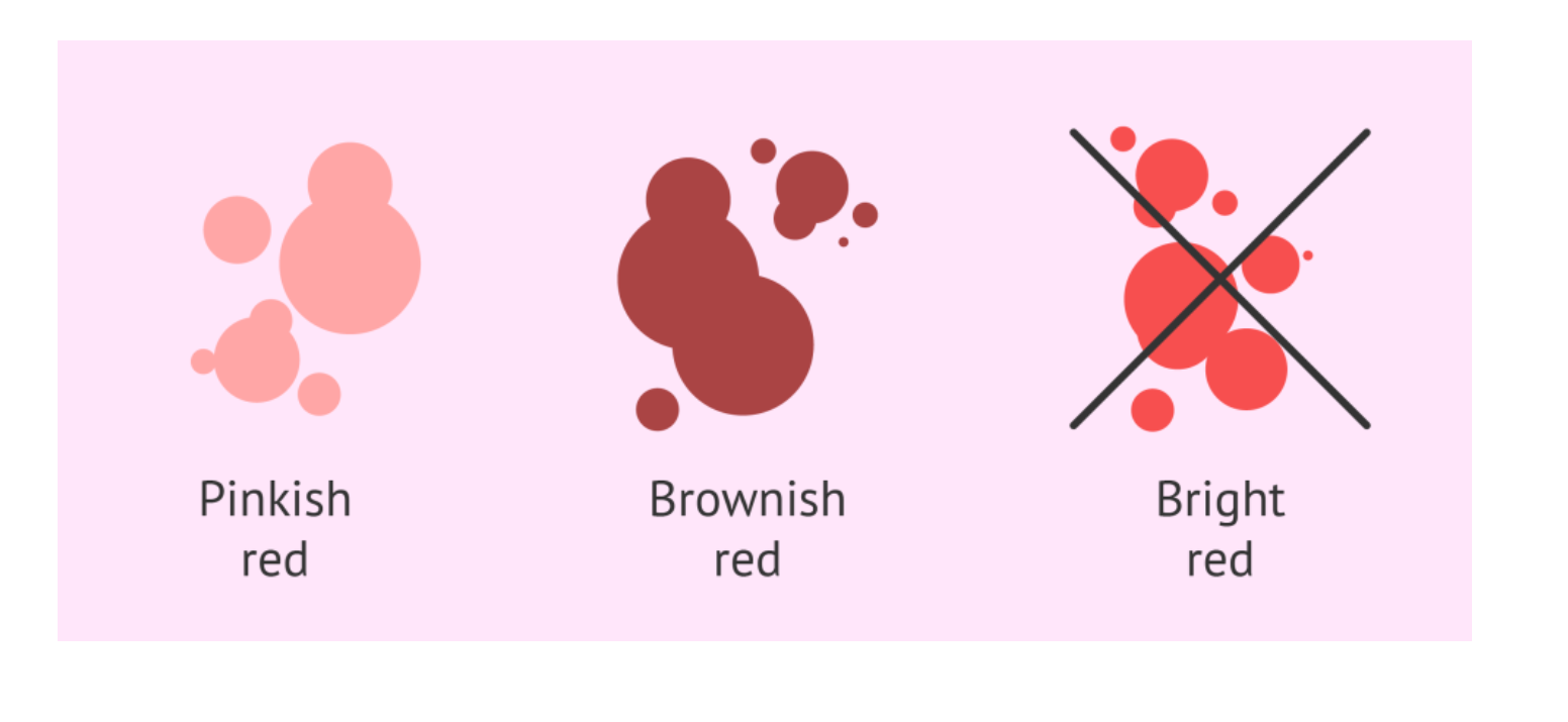 착상혈의 흔한 증상들