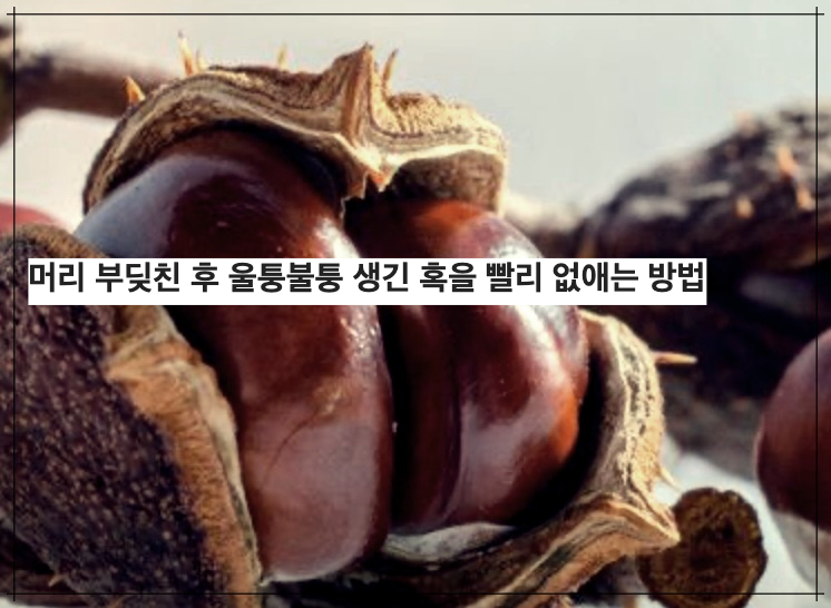 머리 부딪친 후 울퉁불퉁 생긴 혹을 빨리 없애는 방법