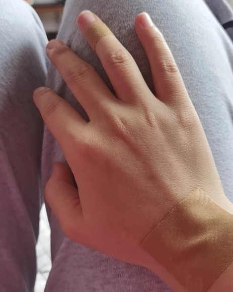 손을다리위에올려놓은사진손저림