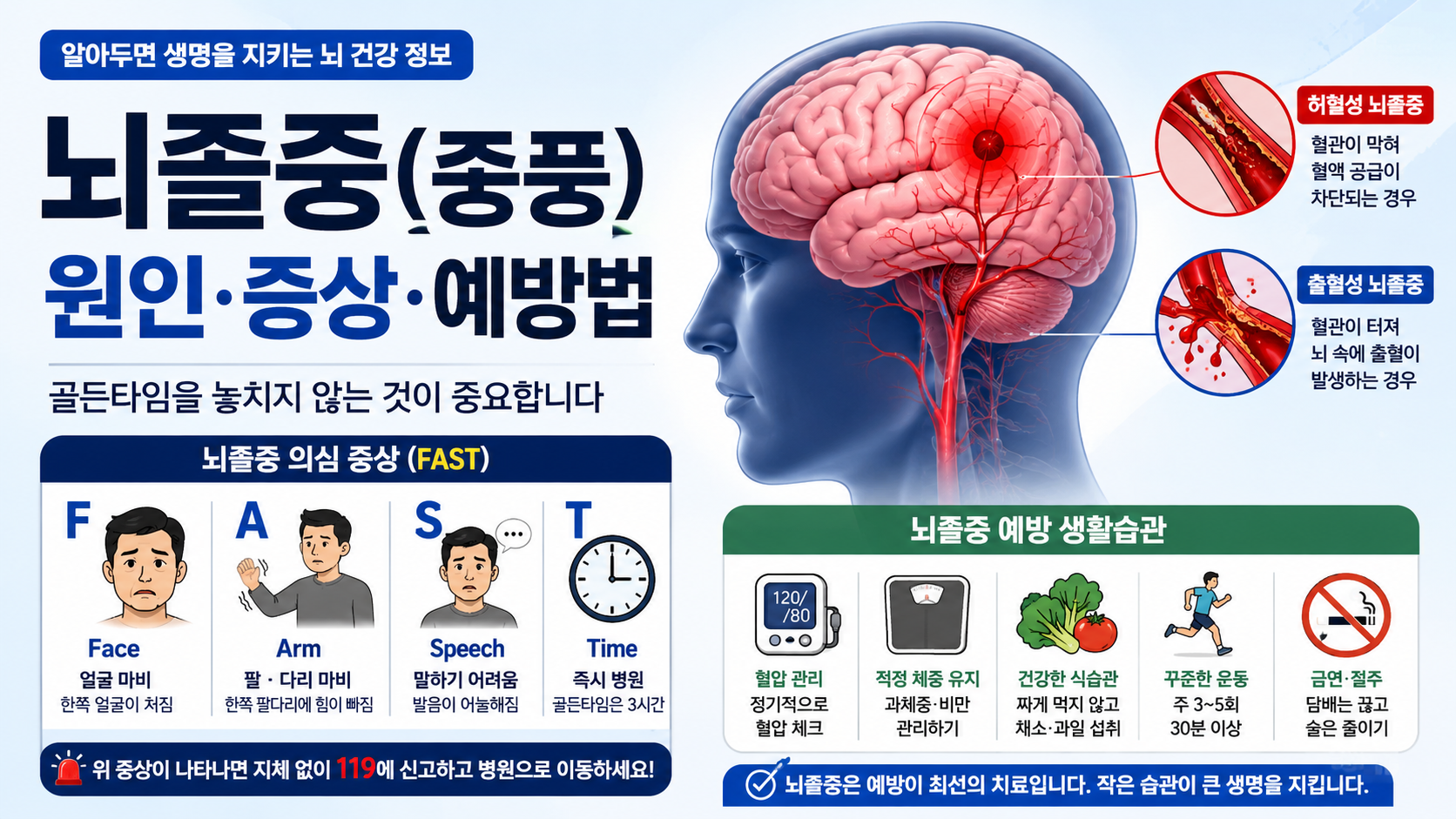 뇌졸중 의심 증상 7가지와 응급실 가야 하는 기준