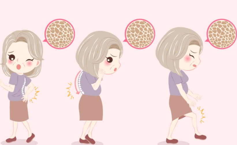 갱년기 증상 30가지