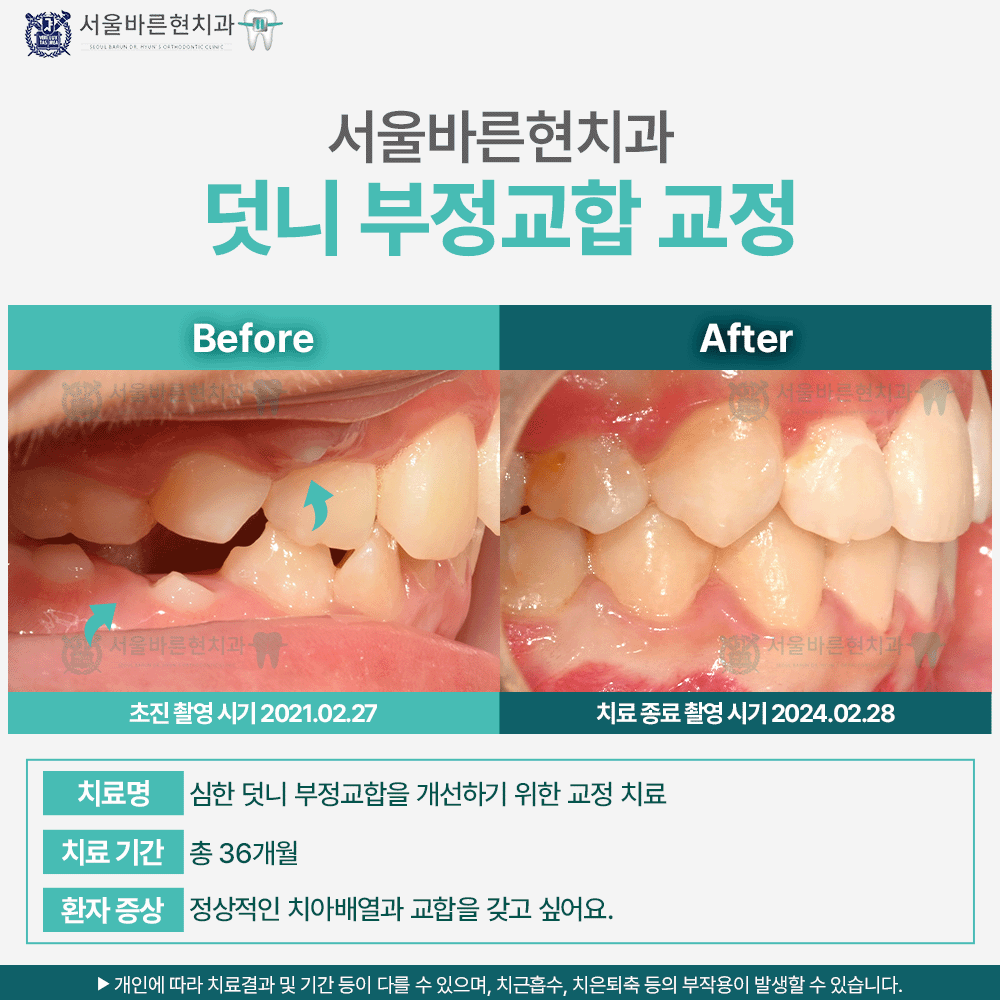 해운대교정치과