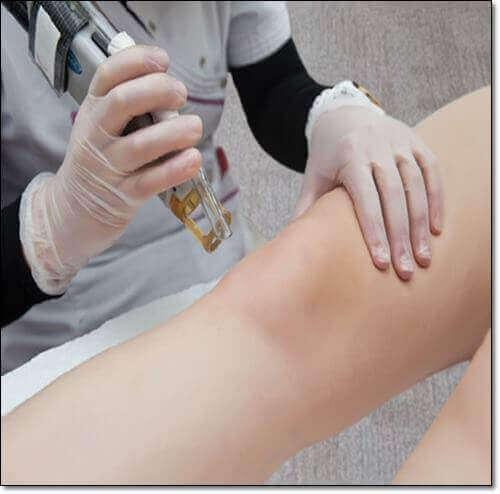 관절염 환자