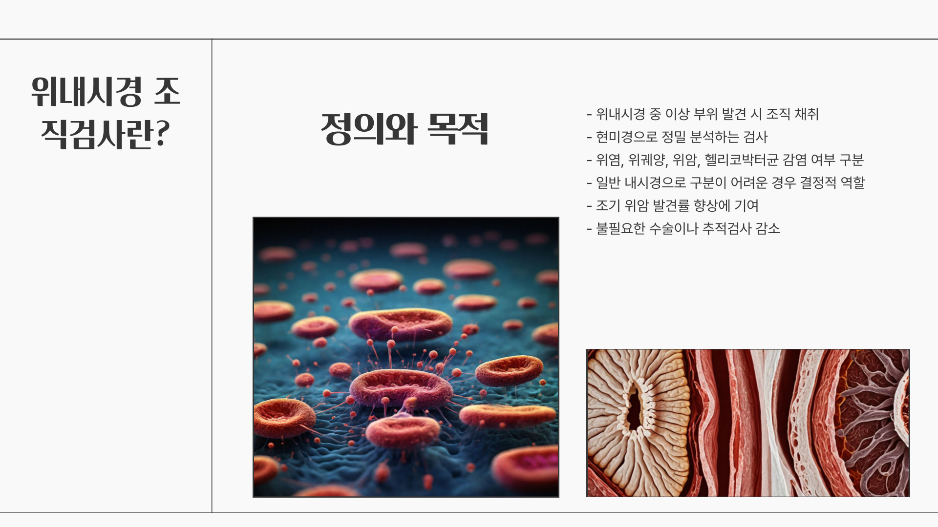 위내시경 조직검사