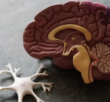 알츠하이머 진단 방법 치료 합병증 예방