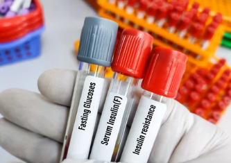 혈당검사 사진/출처:어도비스톡