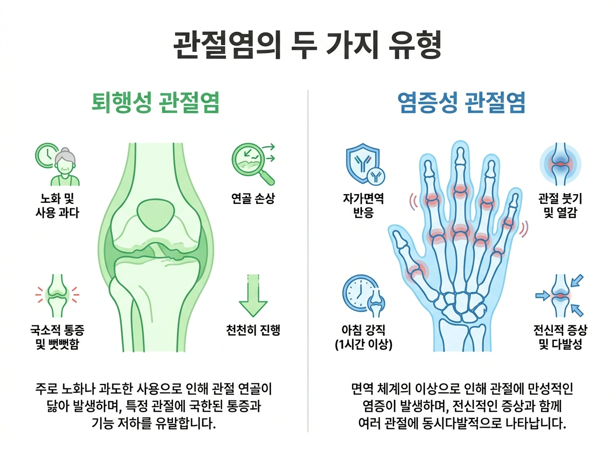 무릎과 손가락 관절을 나란히 비교해 보여주는 한글 인포그래픽