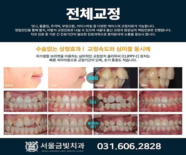 서울금빛치과의원 성남