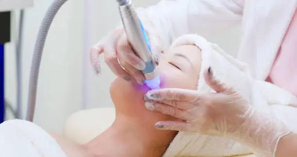 기미 없애는 방법