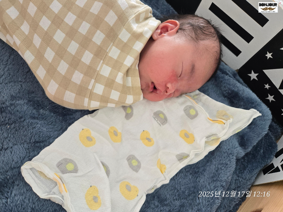 신생아 얼굴에 태열이 꽃피워있는 모습