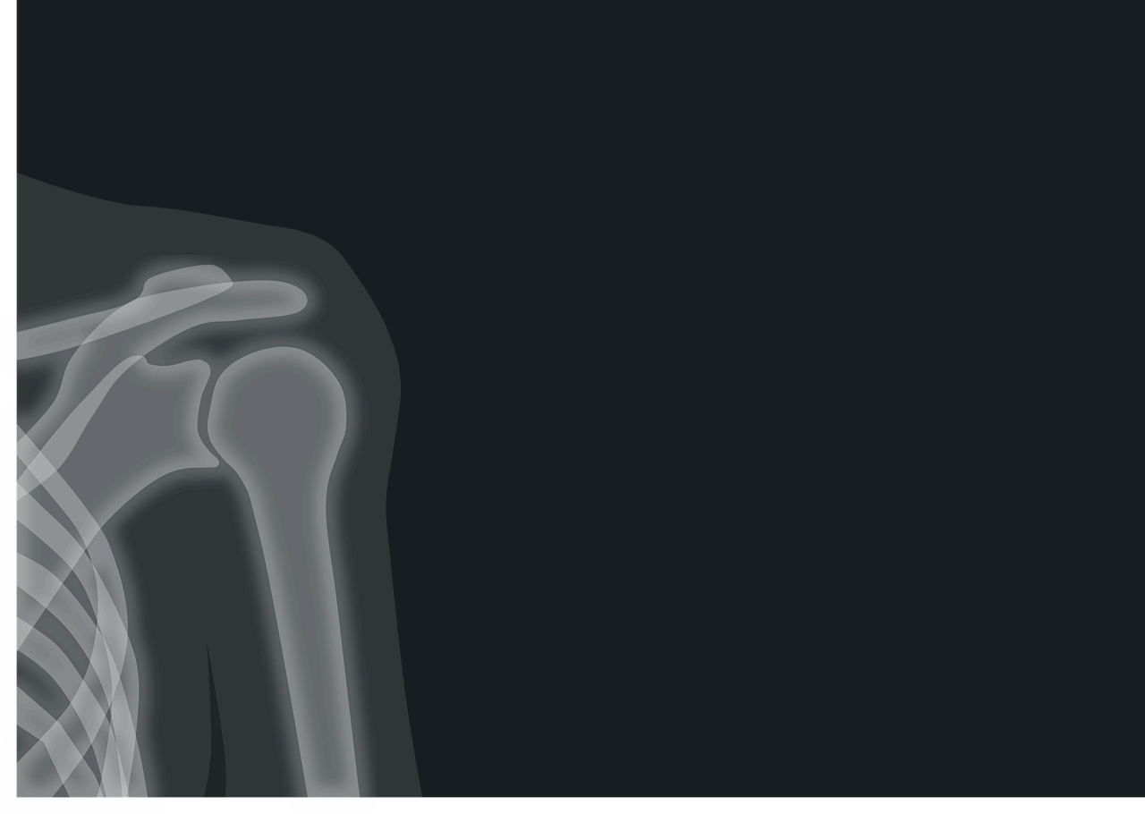 암 방사선 치료 방법과 비용, 회복 관리 과정까지