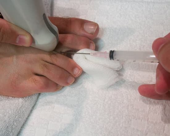 지간신경종(Morton's Neuroma): 원인, 증상, 치료 및 관리