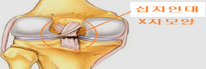 십자인대의 위치