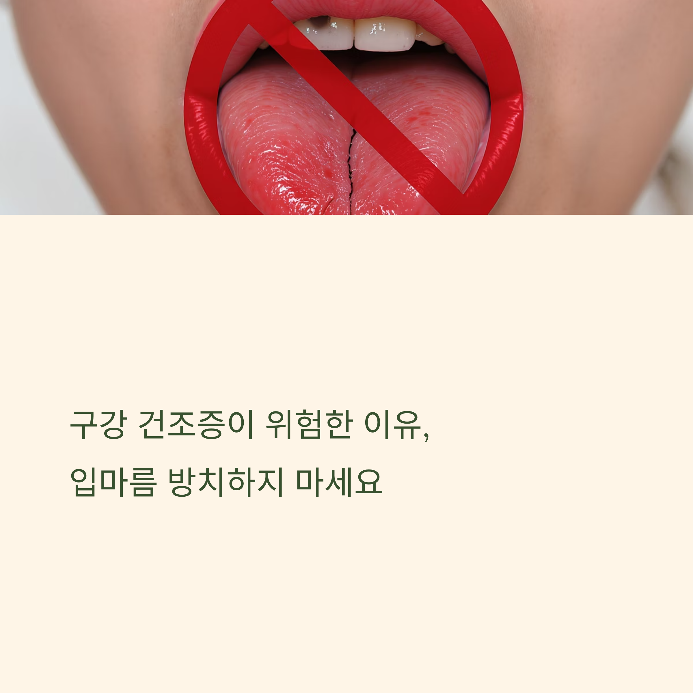 구강 건조증이 위험한 이유, 입마름 방치하지 마세요
