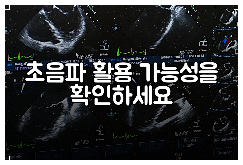 초음파 활용 가능성을 확인하세요